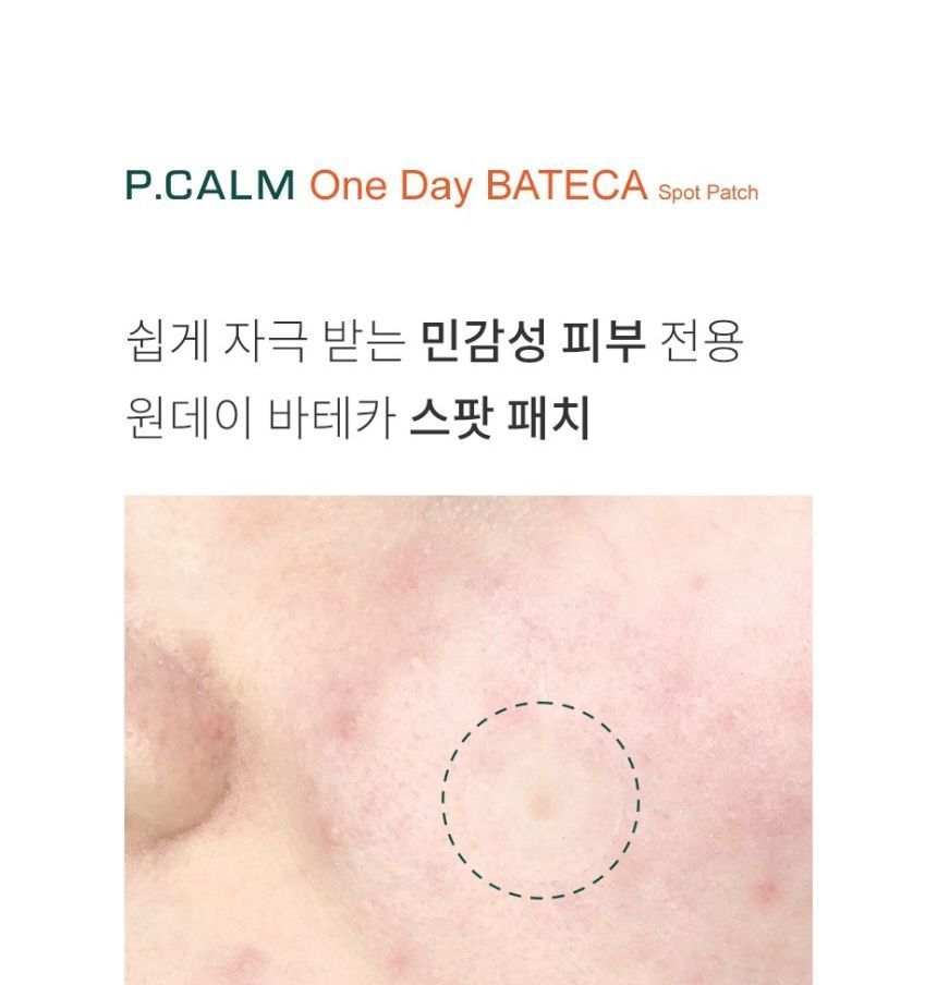 [P.CALM] One Day BATECA spot patch (2*18ea)