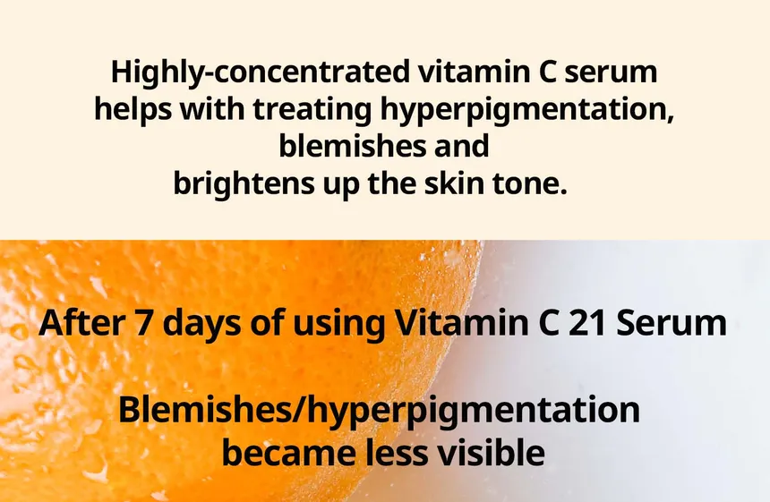 [FRANKLY] Vitamin C 21% Serum 15ml