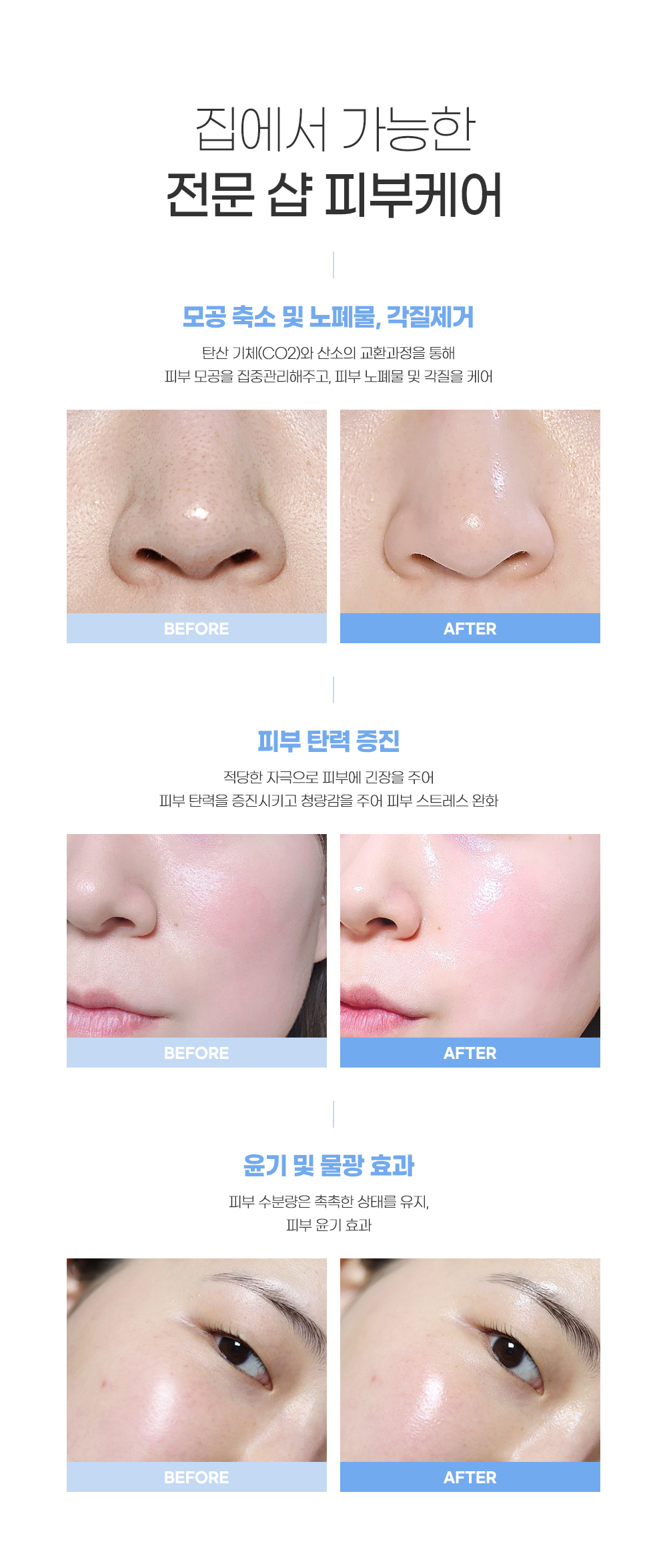 [CP-1] *renewal* Esthetic Formula Co2 Carbonic Mask (5EA)