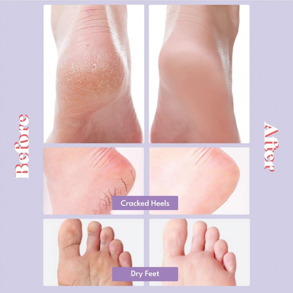 [Toi:L] Extra Silky Foot Mask (5ea)