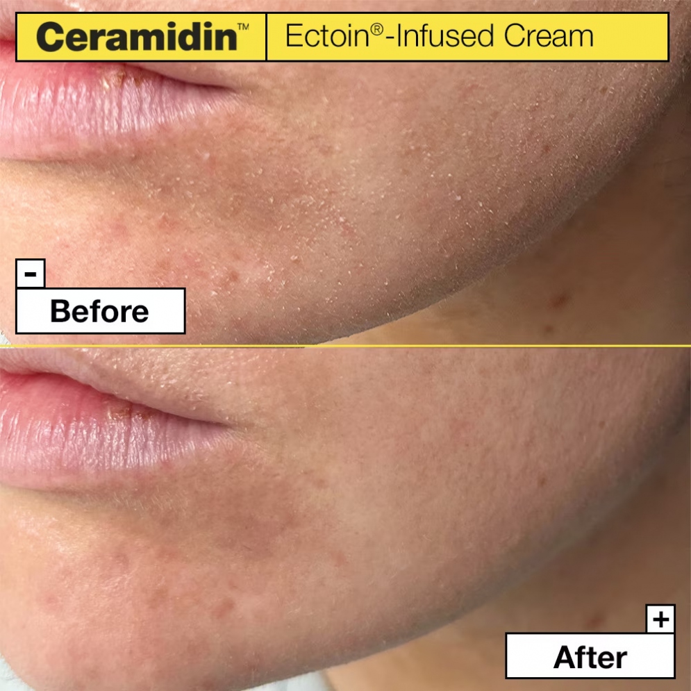 [Dr.Jart+] Ceramidin Ectoin-Infused Cream 50ml